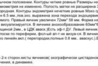 big_fa6b8fa84539f44f351c_IMG_0457.webp